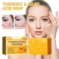 thumbnail image 1 of Organic Turmeric Soap for Dark Spots & Acne, Turmeric Soap for Skin Brightening and Clearing Formula, All Natural Turmeric Soap Bar, 1 of 9