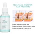 thumbnail image 2 of Serum for Ingrown Hairs, 30ml Razor Bumps Solution, Post-Hair Removal Repair Solution for Men Women, Reduce Redness & Dark Spots, 2 of 4
