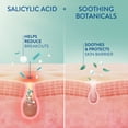 thumbnail image 4 of Cetaphil Gentle Clear Hydratant Antiacné à l'Acide Salicylique / Hydratant pour le Visage Hydratant Traite la Peau Sensible à Tendance Acnéique / Sans Parfum / Non Comédogène / Recommandé par des Dermatologues, 4 of 6