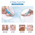 thumbnail image 4 of Foot File Set, Feet Rasp Files, Foot Files For Callus Remover, Pedicure Tool Set, Stainless Steel Foot Rasp Foot File For Pedicure And Foot Care, Professional Pedicure Tool, 4 of 6