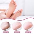 thumbnail image 4 of Transemion 50pack/lot Smooth And Polished Feet Achieved Professional Foot Rasp Fast 1Set, 4 of 6