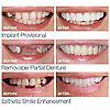 thumbnail image 2 of Smile Snap On False Teeth Upper Lower Dental Veneers Dentures Tooth Cover Set _fs, 2 of 5