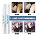 thumbnail image 2 of 5ml Pets Teeth Cleaning Tool Dogs Cats Tartar Remover Dental Stones Scraper Plastic Cleaning Pen Cleaning Tools, 2 of 4