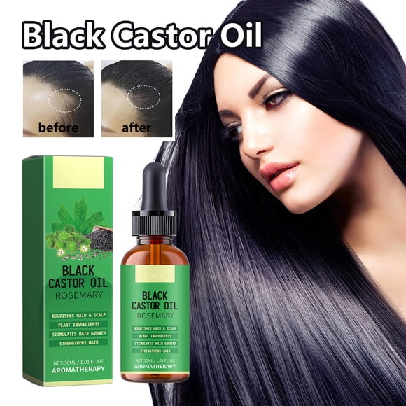 NARABB Black Castor Oil Hair Growth Oil With Biotin And Castor Hair Growth Serum For Thicker Longer Healthier Hair Promotes Hair Regrowth Hair Regrowth Oil 30ml