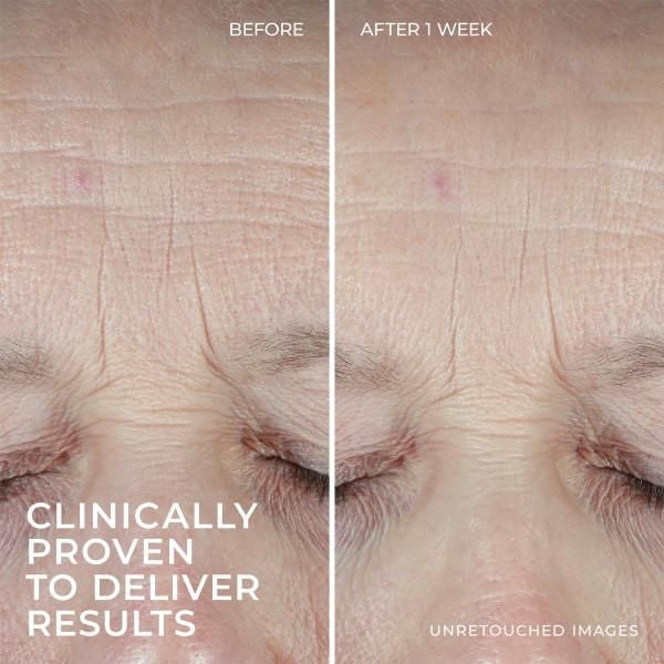 RoC Skincare - Hydration + Moisturizer®️ - + Hyaluronic Acid + Collagen Protein