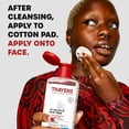 thumbnail image 2 of Thayers 2% SA Salicylic Acid Toner, 2 of 5