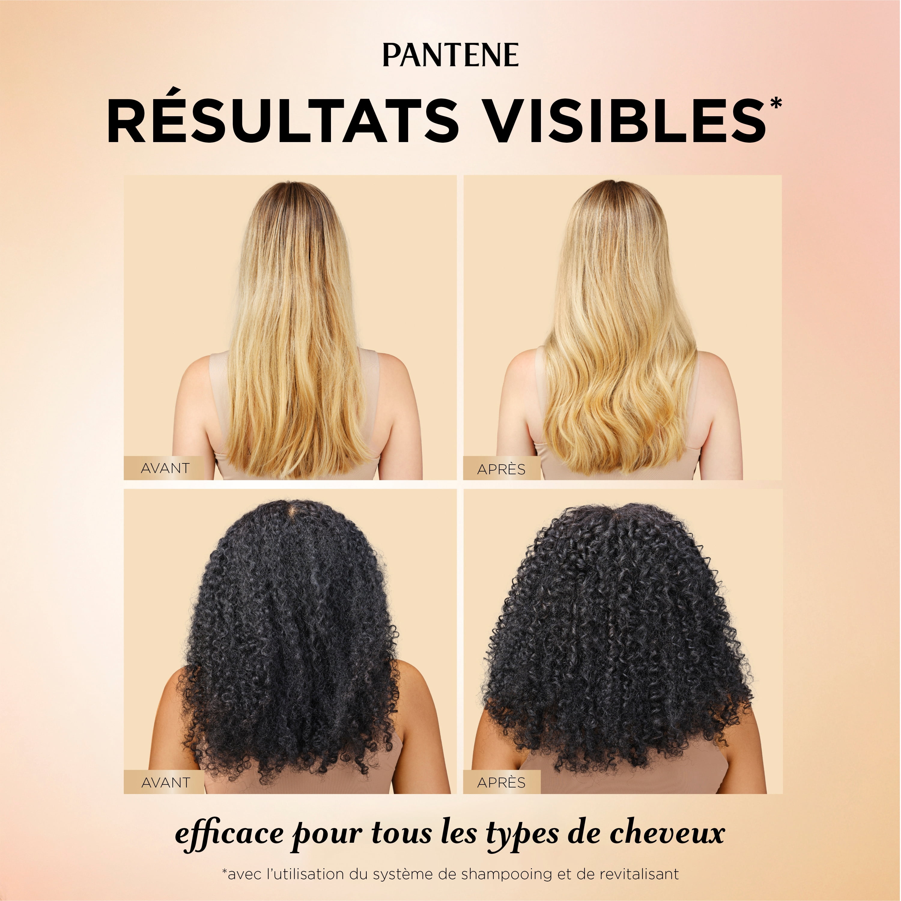 Revitalisant Pantene Pour Cheveux Abondants et Forts, Renforce Les Cheveux De La Racine À La Pointe, Complexe De Pro-Vitamine B5 et Antioxydants, 237 mL