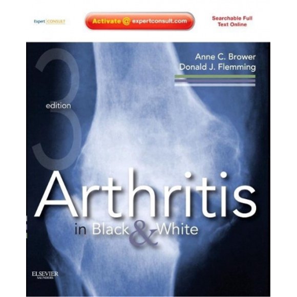 Arthritis in Black and White: Expert Consult - Online and Print