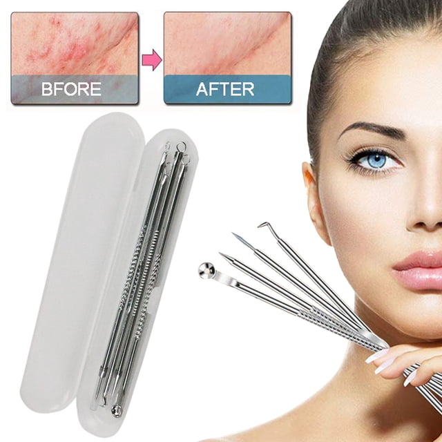 Pimple Tool Kit With Extractor Milia Removal Tool Blackhead Tweezers And Remover Tool Set,Silver Beauty Equipment