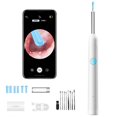 thumbnail image 1 of Ear Cleaner with Camera, Smart Visual Otoscope Ear Cleaner with Camera Endoscope, Ears Wax Remover Otoscope, Earpick Rechargeable Earwax Remover Ears Care Set for Adults, 1 of 8