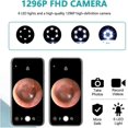 thumbnail image 3 of Ear Wax Removal Kit Wifi With Camera, Visible Spoon For Ear Cleaning, 1080p Hd Otoscope Tool With Usb Load, 3 of 5