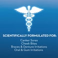 thumbnail image 3 of Oral-B Lésion Buccale Special Care Rince-Bouche, 3 of 12