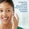 thumbnail image 3 of Cetaphil Gentle Clear Hydratant Antiacné à l'Acide Salicylique / Hydratant pour le Visage Hydratant Traite la Peau Sensible à Tendance Acnéique / Sans Parfum / Non Comédogène / Recommandé par des Dermatologues, 3 of 6