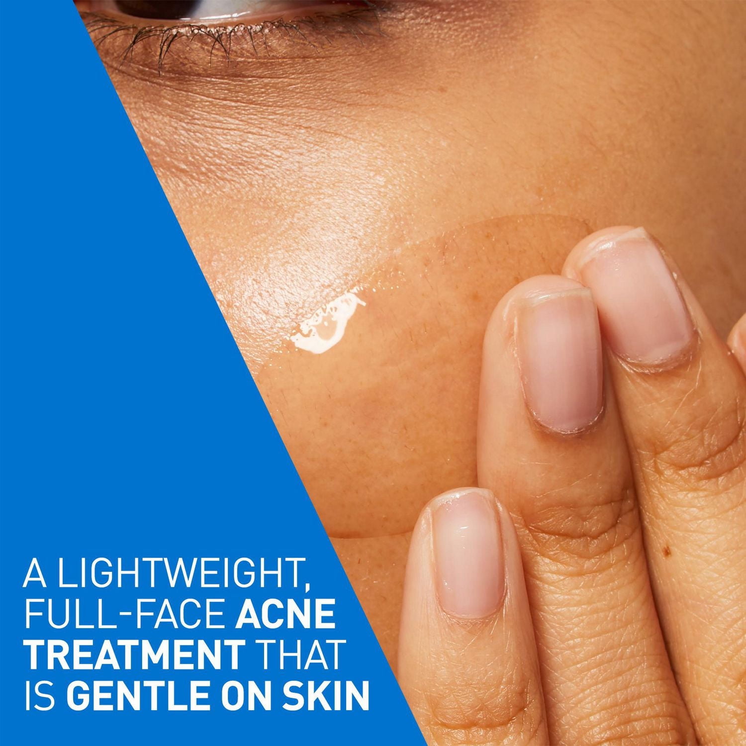 CeraVe Gel Contrôle de l'Acné, Traitement avec 2 % d'Acide Salicylique et AHA pour Visage, 40 ml