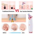 thumbnail image 4 of CYC Electric Blackhead Remover Pore Vacuum Suction Diamond Dermabrasion Face Cleaner, 4 of 5