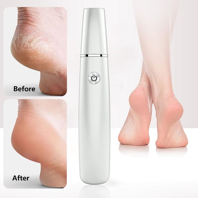 Birdeem Foot Callus Remover, Foot Callus Remover, Charging Electric Foot File with Multiple Speeds - Portable Callus Remover for Home Use, Foot File Callus Remover, Foot File Callus Remover
