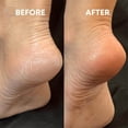 thumbnail image 2 of RKSTN Foots File Foot File Glass Foot File Callus Remover Glass Foot File For Heel Shower Foot Dead Skin Remover, 2 of 8