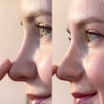 thumbnail image 3 of Maskeraide, Hydrocolloid Nose Patches, Nose strips, Pore strips, Spotted Pores, 3 of 5