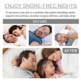 thumbnail image 2 of Anti Snore Mouthpiece, Sleep At Night Anti-snoring Molar Teeth Guard Protective Braces, 2 of 5