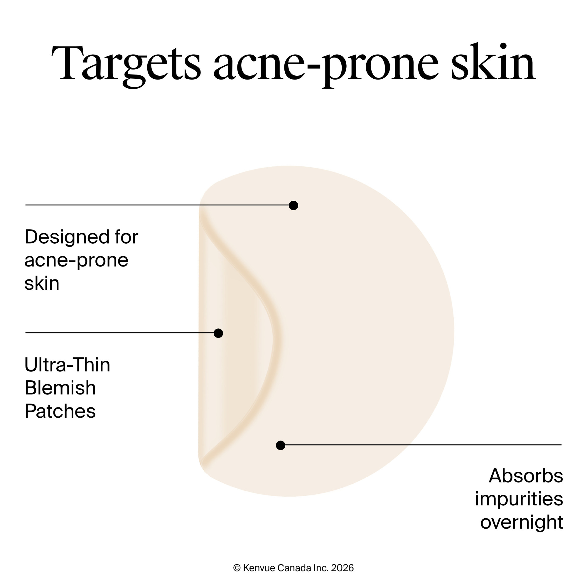 Neutrogena Stubborn Acne Blemish Patches, Hydrocolloid Spot Treatment, Pimple Care Patch, Hypoallergenic, Duo Pack