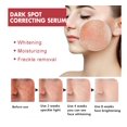 thumbnail image 2 of Sérum Anti-Imperfections Niacinamide 10 % + TXA 4 % (30 ml), 2 of 5