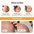 thumbnail image 4 of Hero Cosmetics Mighty Patch Surface – Grands Patchs Hydrocolloïdes pour les Boutons sur le Corps, le Dos et le Visage, Adaptés aux Peaux Sensibles, 4 of 7