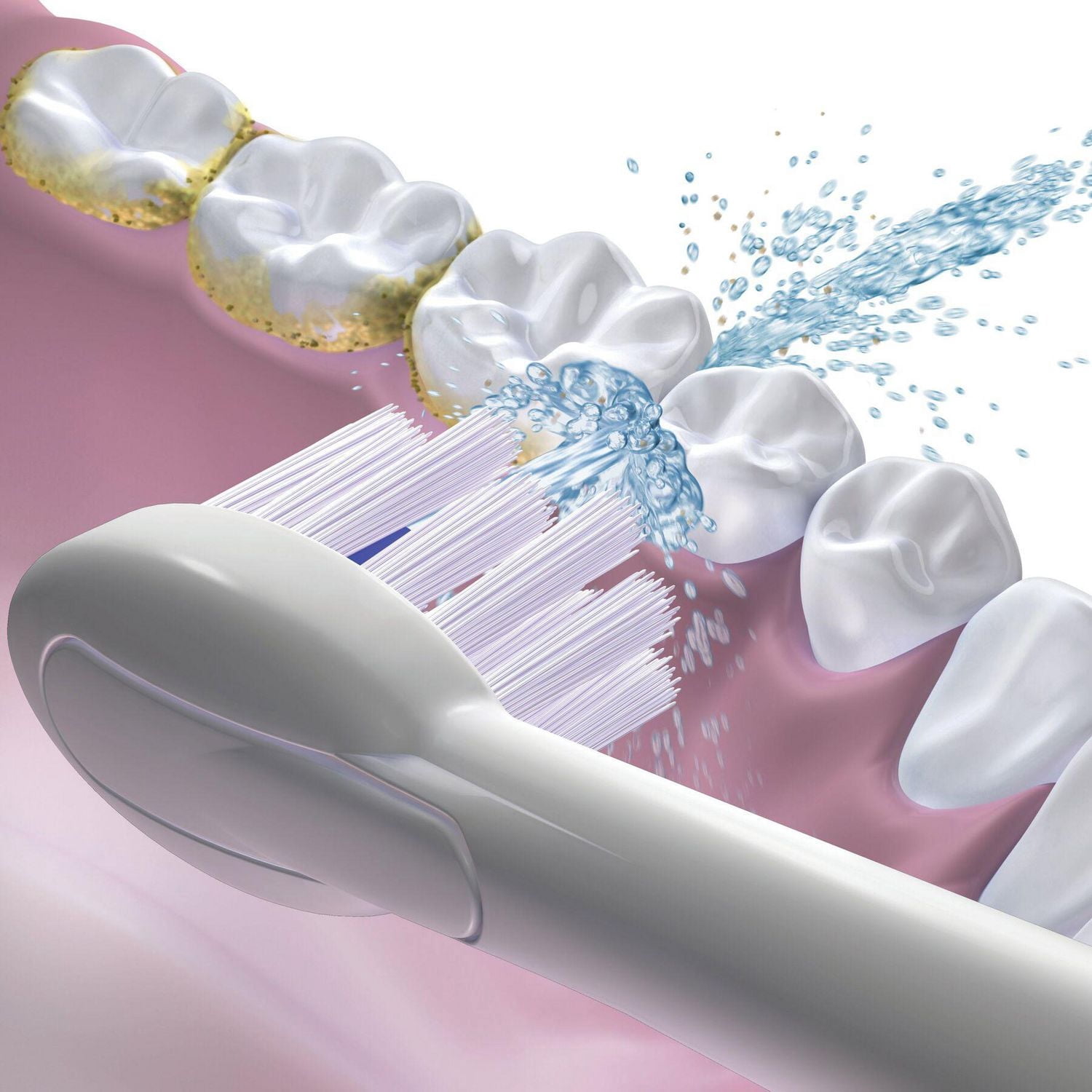 Waterpik® Sonic-Fusion® Têtes de Brosse de Rechange Pleine Grandeur pour Fil Dentaire