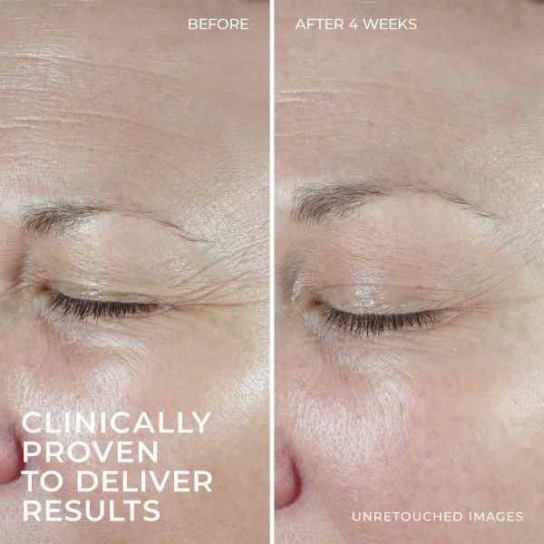 RoC Skincare - Hydration + Moisturizer®️ - + Hyaluronic Acid + Collagen Protein