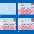 thumbnail image 3 of Floss Threaders,Deep Clean Floss for Braces, Bridges, and Implants, 3 of 4
