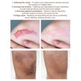 thumbnail image 4 of Élimination des Cicatrices Marques de Cicatrice pour le Visage Ou le Corps, 4 of 9