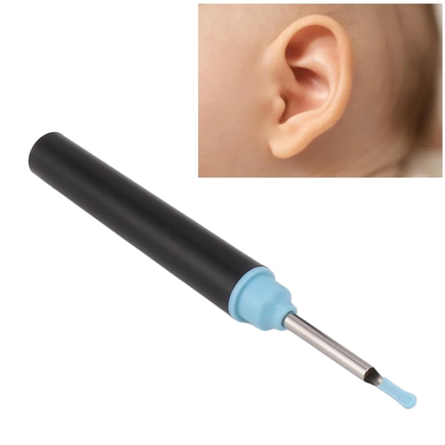 Ear Cleaning Camera, Constant Temperature Smart 2MP Ear Wax Removal Camera 360 Degree View with 6 Silicone Tips for Adults