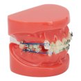 thumbnail image 1 of Metal Wires Teeth Model,Dental Model Metal Wires Metal Wires Dental Model Orthodontics Model Finest Materials, 1 of 14