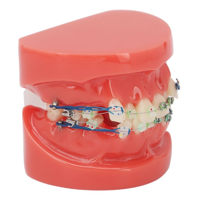 Metal Wires Teeth Model,Dental Model Metal Wires Metal Wires Dental Model Orthodontics Model Finest Materials