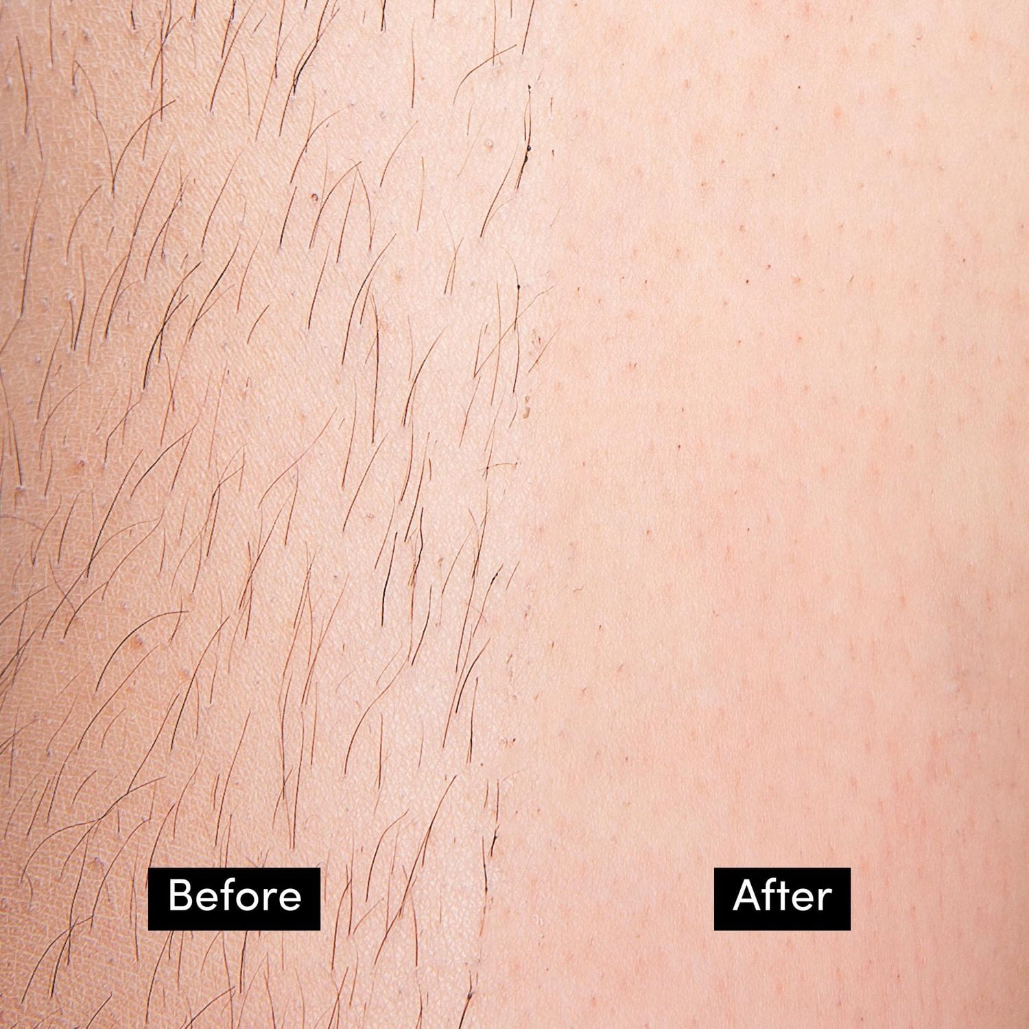 Persian Cold Wax Hair Remover