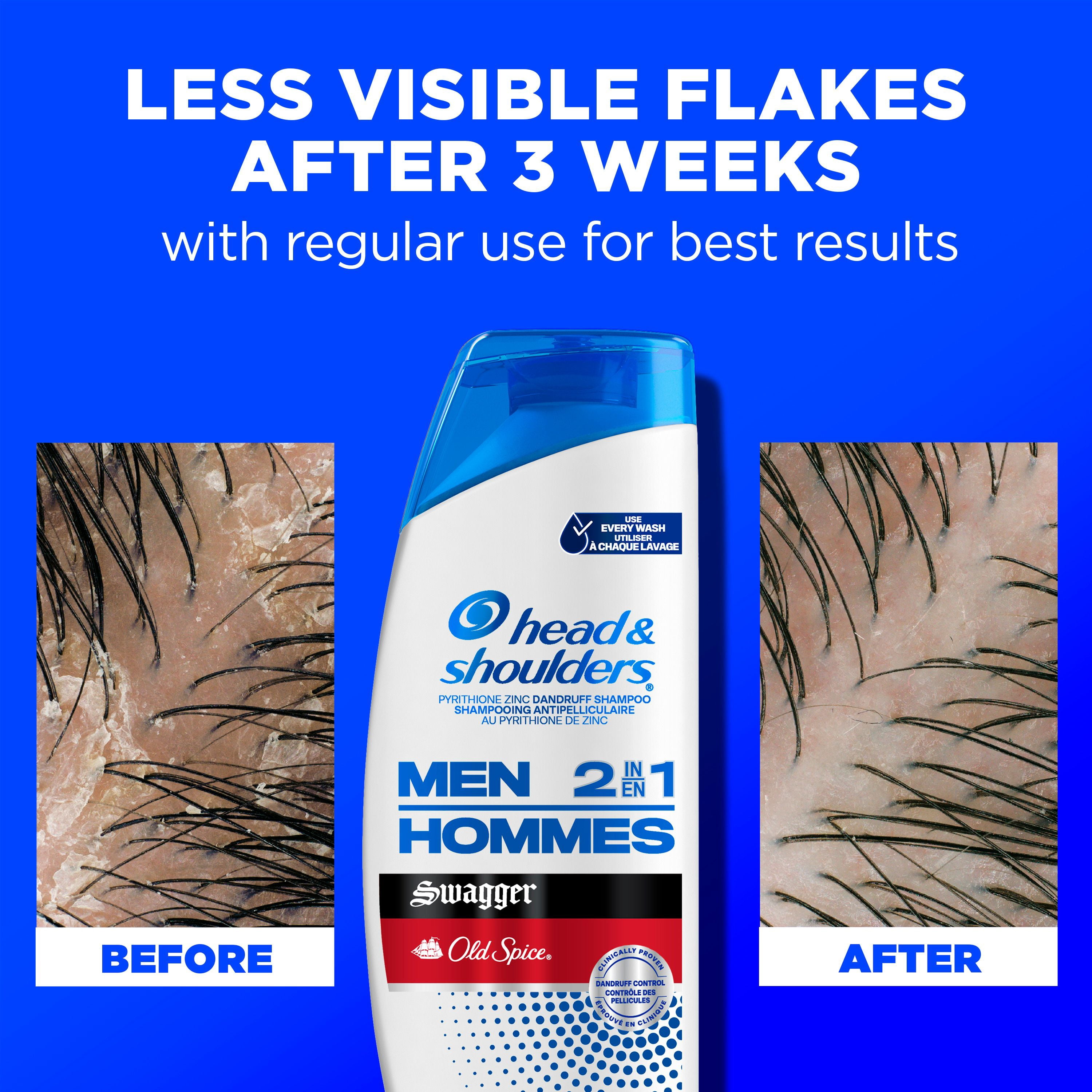 Head and Shoulders Mens 2 1 Dandruff Shampoo Conditioner, Anti-Dandruff Treatment, Old Spice Swagger for Daily Use, Paraben Free, 835ML