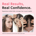 thumbnail image 3 of 2PCS FORCHICS Hair Growth Spray - Hair Oil Mist,Moisturizing Leave-In Conditioner,Anti-Frizz Scalp Treatment,Vegan Hair Care Formula,1.7 fl oz, for All Hair Types Makeup Organizers, 3 of 5