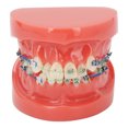 thumbnail image 2 of Metal Wires Teeth Model,Dental Model Metal Wires Metal Wires Dental Model Orthodontics Model Finest Materials, 2 of 14