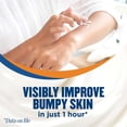 thumbnail image 4 of Gold Bond Rough & Bumpy Daily Skin Therapy Cream 8 Oz. With 7 Moisturizers & 3 Vitamins, 4 of 5