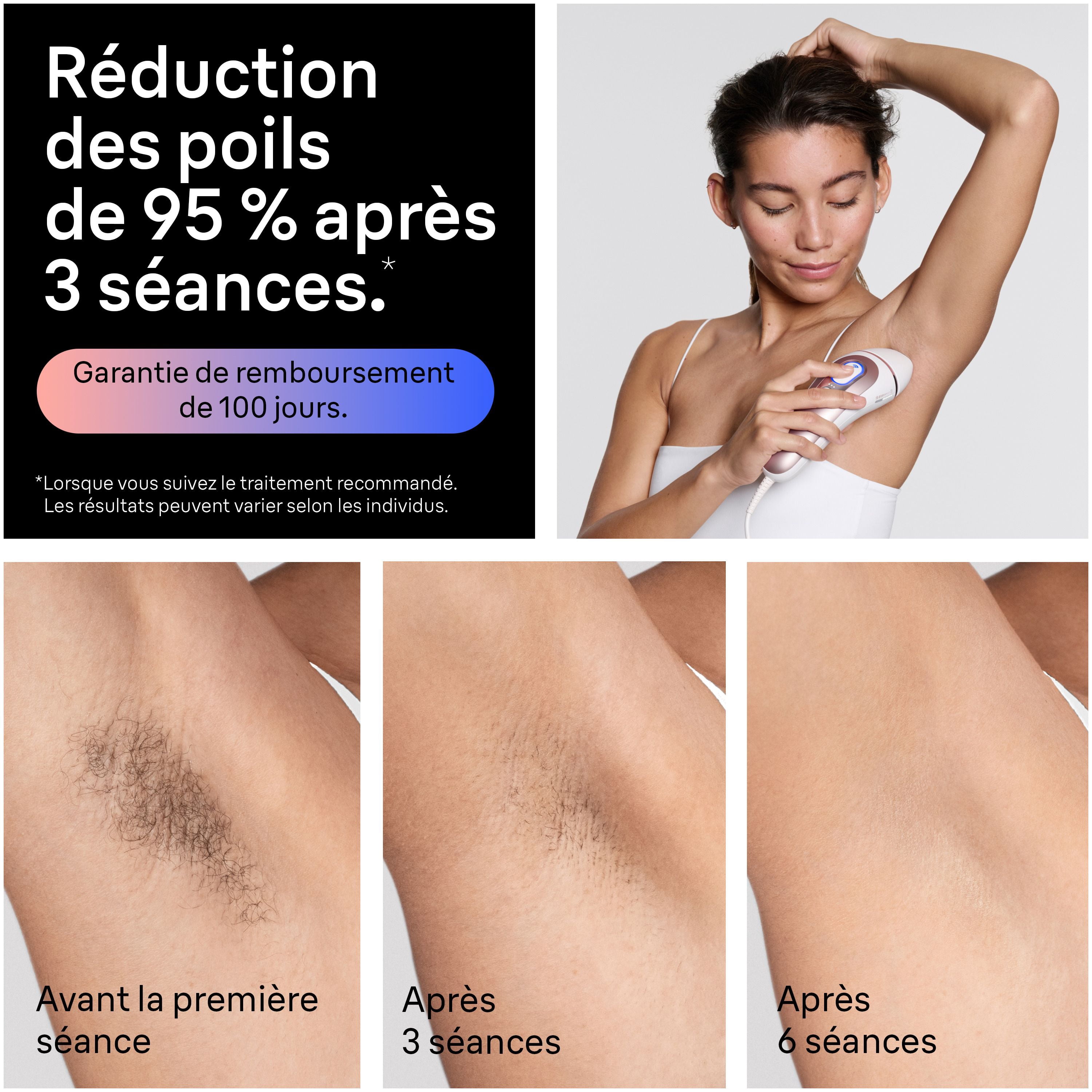 Système d’épilation à domicile Braun Peau i-expert, technologie LIP intelligente, PL7243, pour femmes et hommes, avec application, avec étui haut de gamme, 3 têtes, rasoir Venus