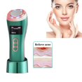 thumbnail image 1 of 4 in 1 Skin Therapy Wand - Ion Therapy LED Light Machine - Anti Aging - Lift & Firm Tighten Skin Wrinkles, 1 of 9