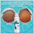 thumbnail image 4 of Footlogix DD Cream Mousse Formula 4.2 oz / 125 ml, 4 of 6
