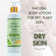 thumbnail image 2 of Aloe & Colloidal Oats Natural Body Lotion for Soothing Relief & Deep Hydration - 8 oz by LatherGreen, 2 of 6