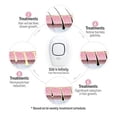 thumbnail image 3 of Silk'n Infinity Hair Removal Device, 3 of 6