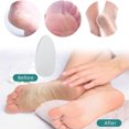 thumbnail image 4 of RKSTN Foots File Foot File Glass Foot File Callus Remover Glass Foot File For Heel Shower Foot Dead Skin Remover, 4 of 8