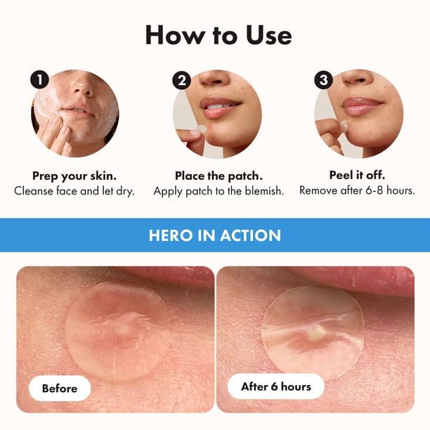 Hero Cosmetics Mighty Patch Invisible+, Barely-There Hydrocolloid