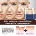 thumbnail image 4 of Wrinkle Removal Wrinkle Remover for Face Firming, 4 of 5
