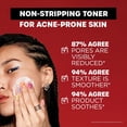 thumbnail image 3 of Thayers 2% SA Salicylic Acid Toner, 3 of 7