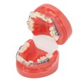 thumbnail image 4 of Metal Wires Teeth Model,Dental Model Metal Wires Metal Wires Dental Model Orthodontics Model Finest Materials, 4 of 14
