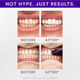thumbnail image 4 of Hismile V34 Teeth Whitening Strips 14pk, 4 of 5