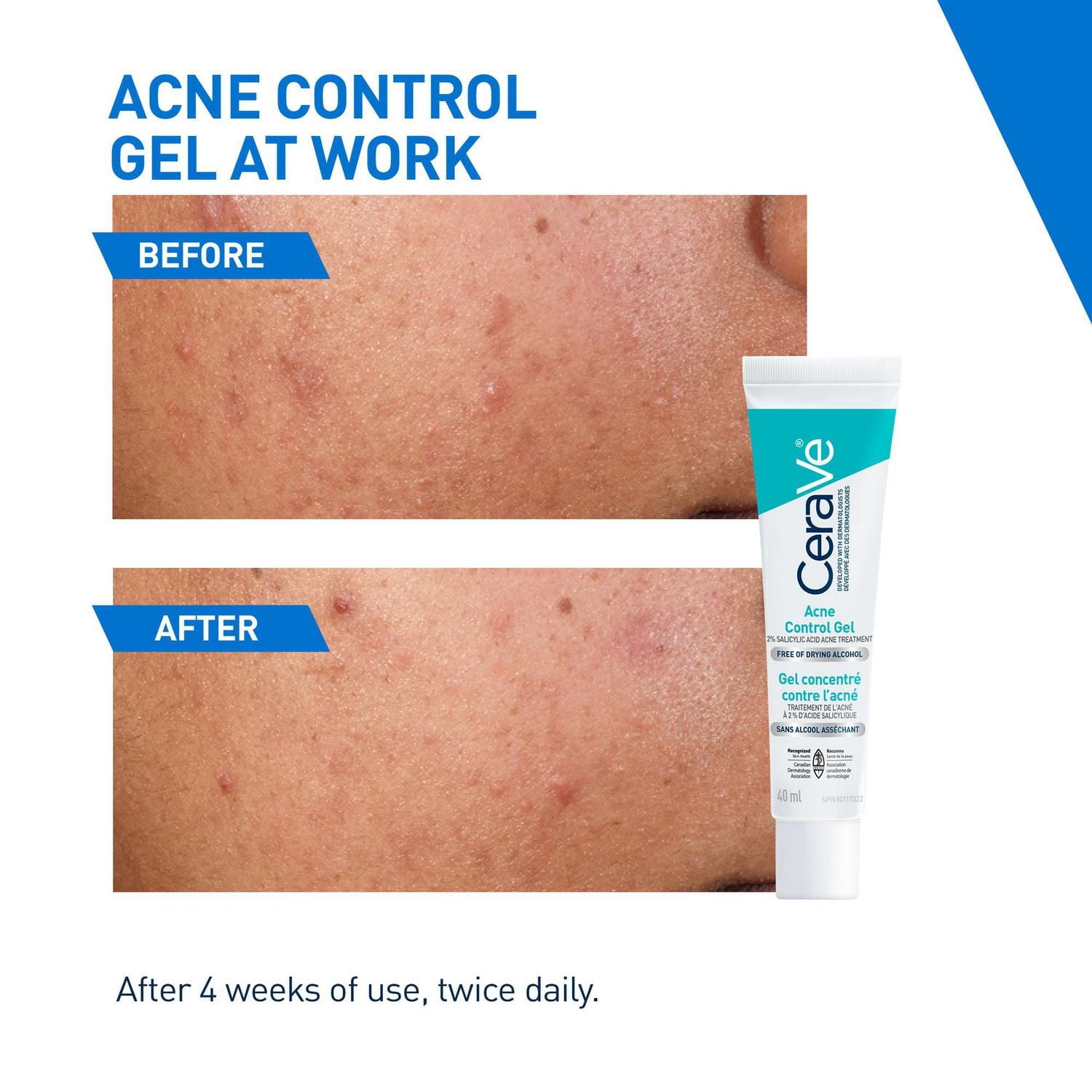 CeraVe Gel Contrôle de l'Acné, Traitement avec 2 % d'Acide Salicylique et AHA pour Visage, 40 ml